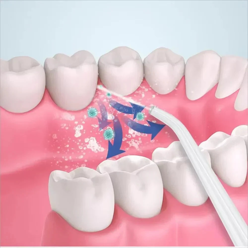 Alphatech™3 In 1 Oral Irrigatorجهاز ري الفم 3 في 1